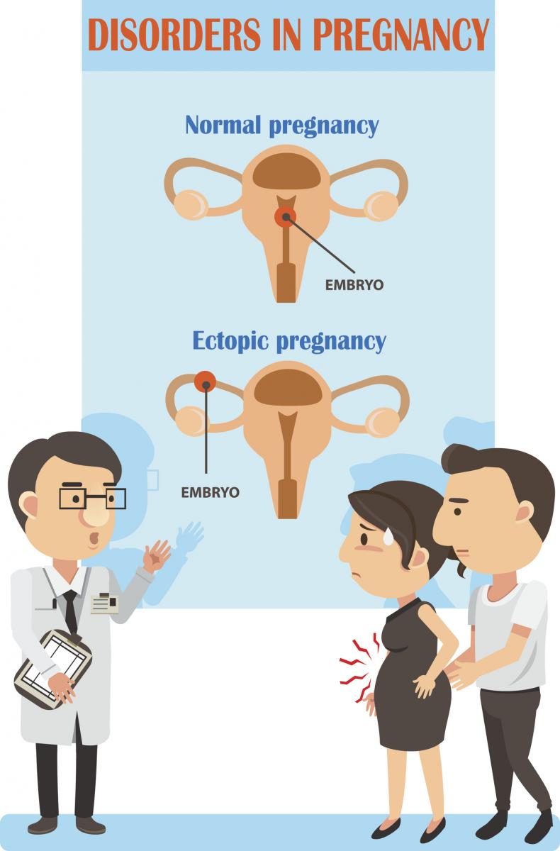 Ectopic pregnancy is a medical emergency Vuk'uzenzele